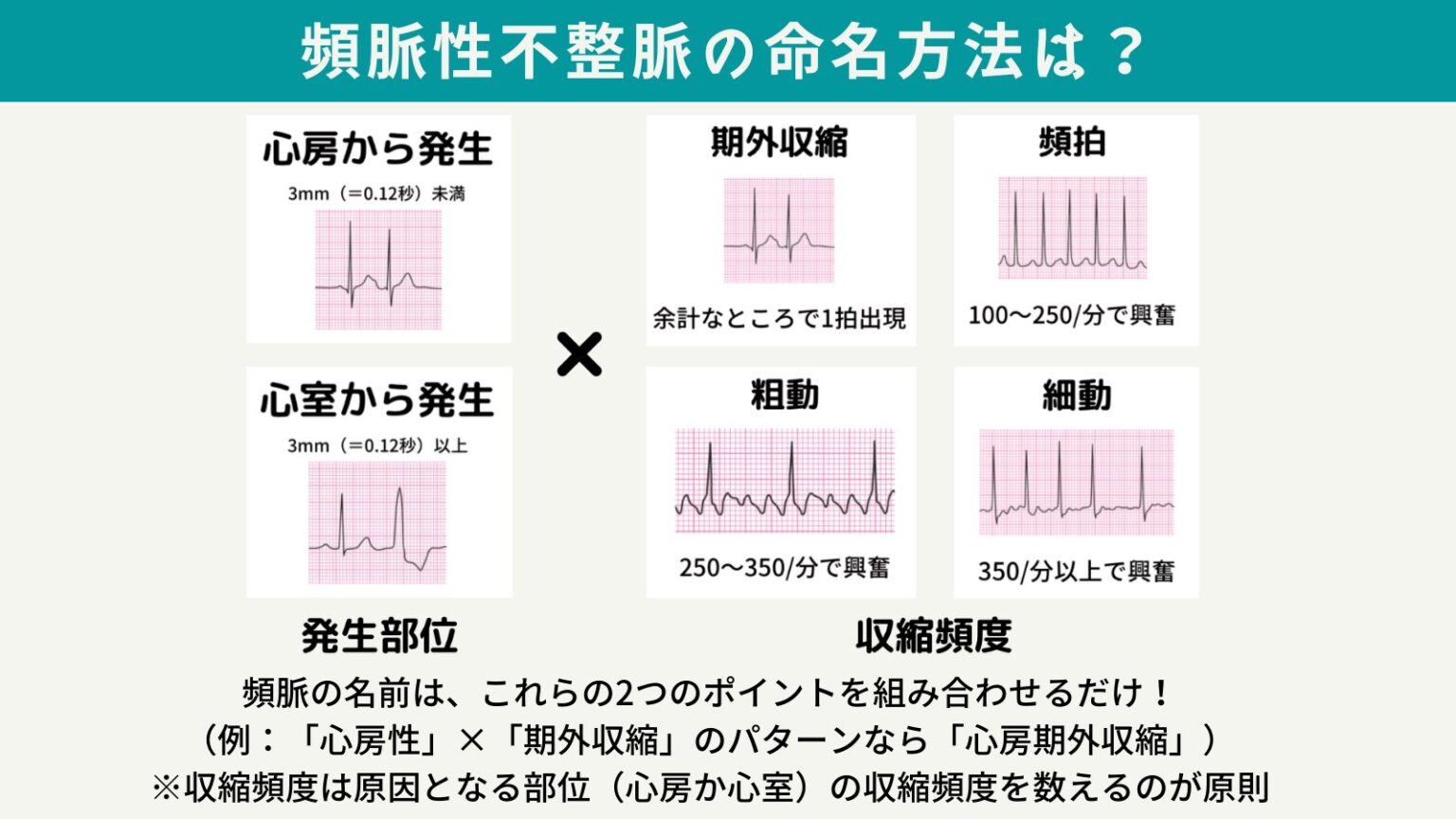 【保存版】心電図読み方のコツ・異常不整脈一覧【救急隊・看護師必見！】 救急救命士学習塾