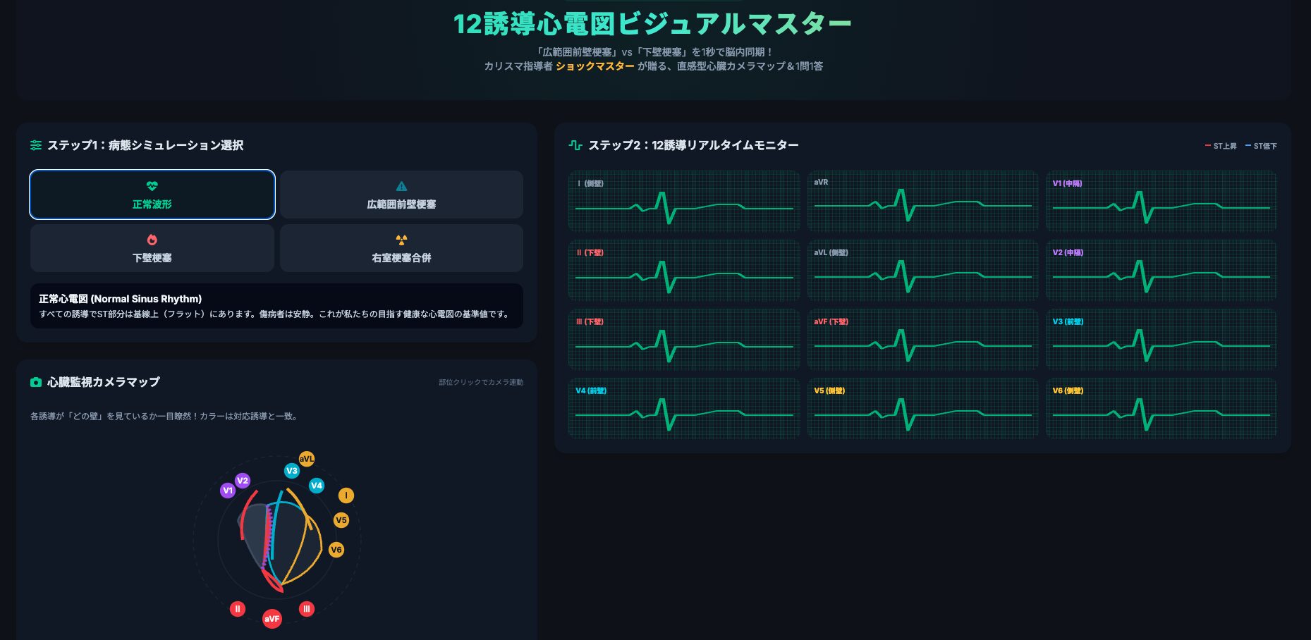 救急救命士のための12誘導心電図