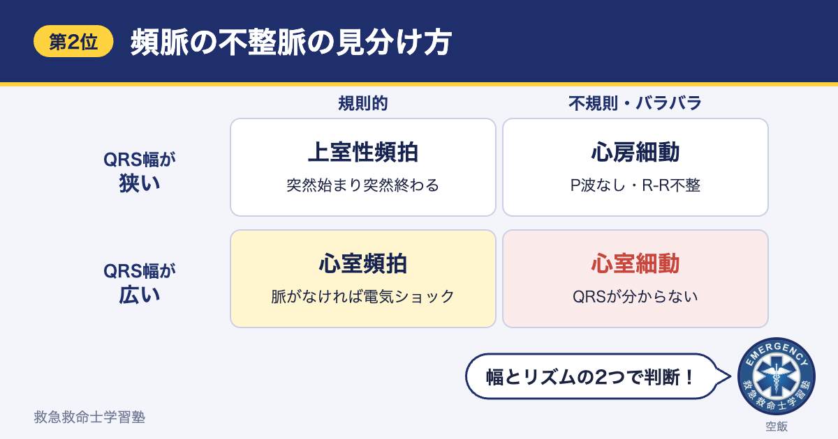 頻脈の不整脈の見分け方（QRS幅とリズムで上室性頻拍・心房細動・心室頻拍・心室細動を区別）